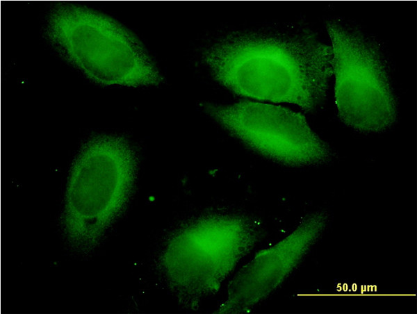 SARS Antibody in Immunocytochemistry (ICC/IF)