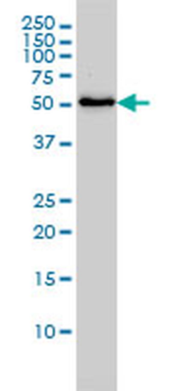 SARS Antibody in Western Blot (WB)