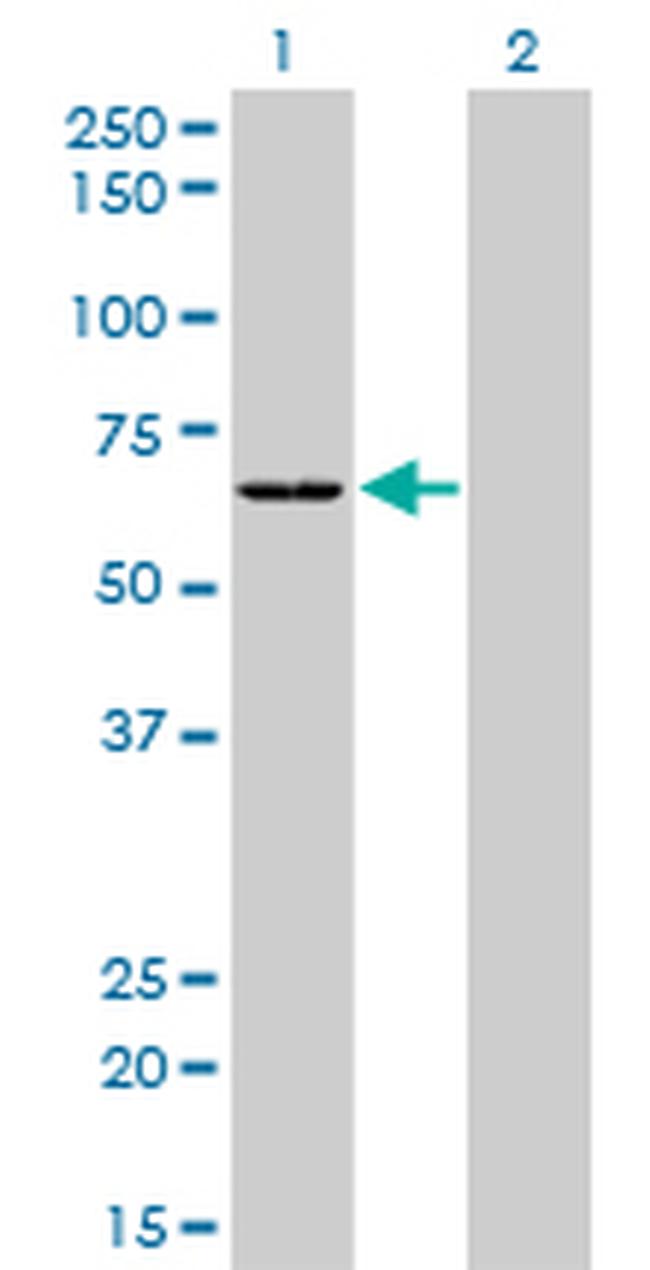 SARS Antibody in Western Blot (WB)