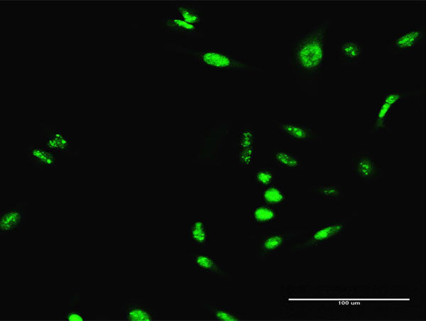 SCML1 Antibody in Immunocytochemistry (ICC/IF)