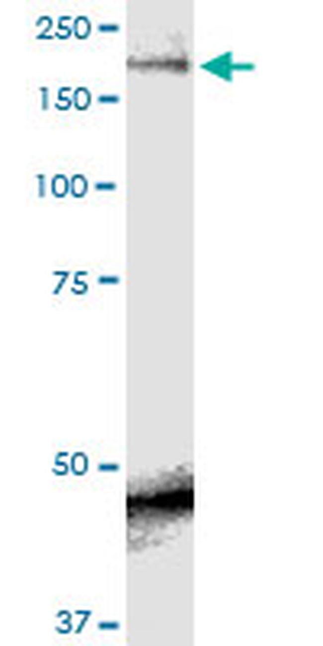 SCN9A Antibody in Western Blot (WB)