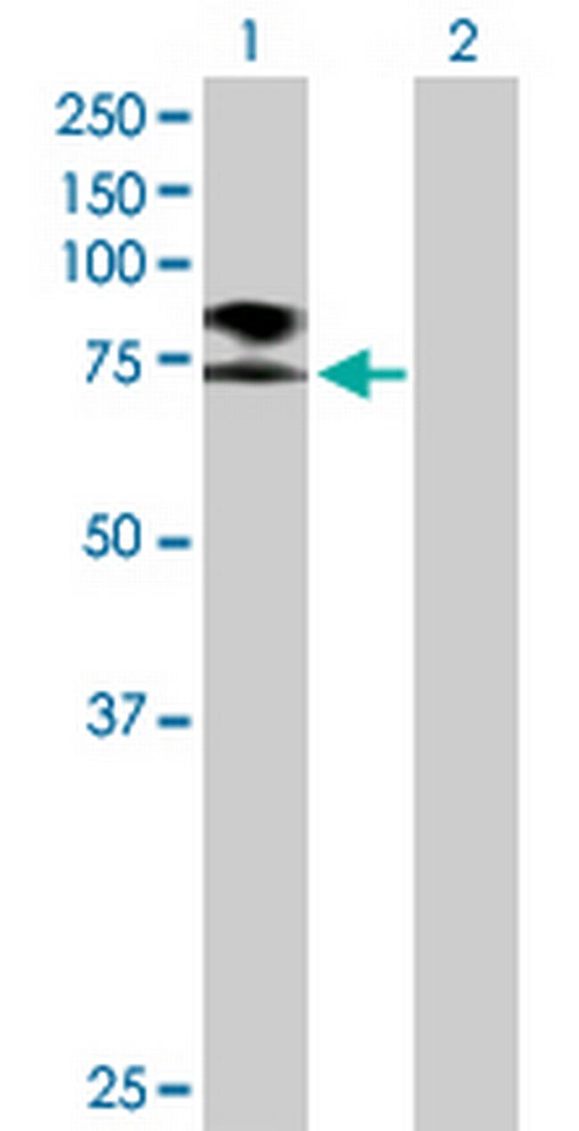 SCNN1B Antibody in Western Blot (WB)