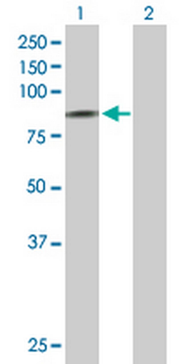 SCNN1D Antibody in Western Blot (WB)