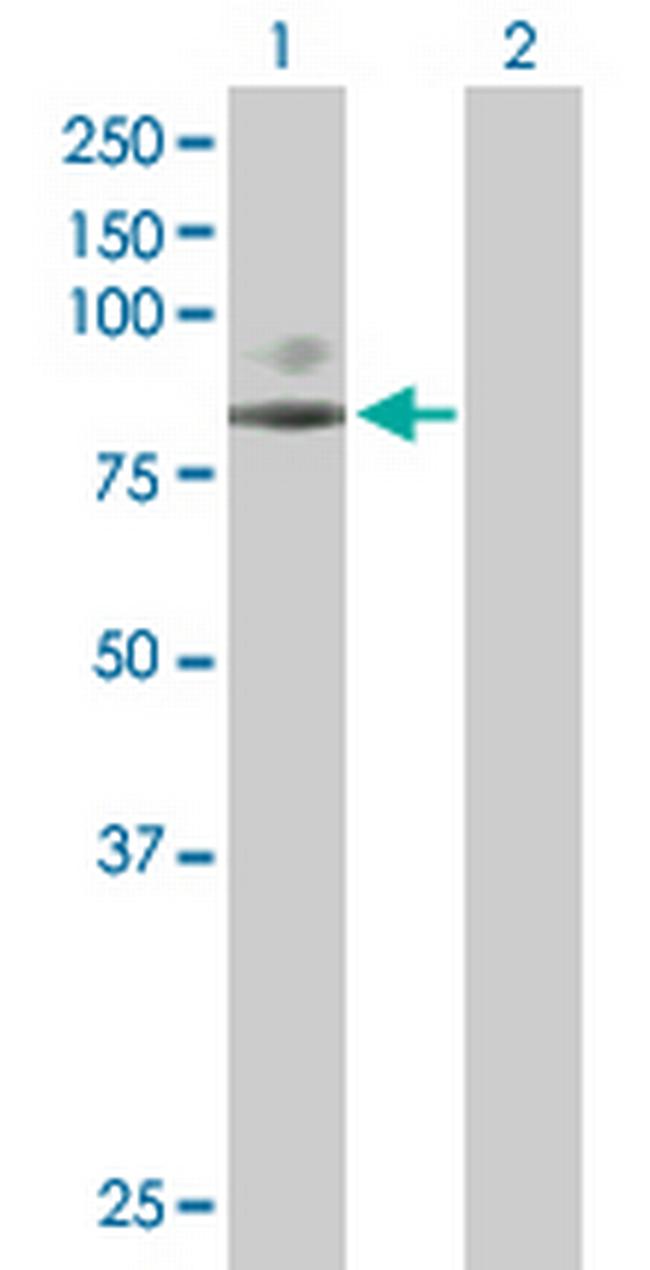 SCNN1G Antibody in Western Blot (WB)