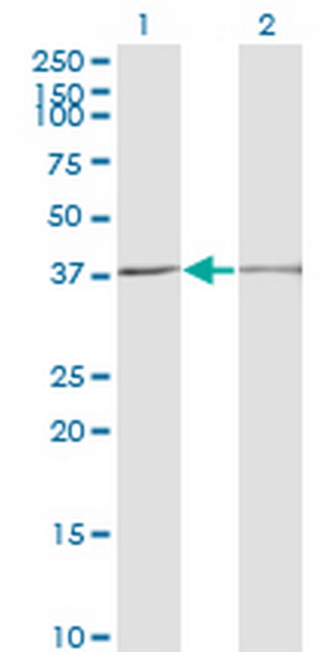 SCP2 Antibody in Western Blot (WB)