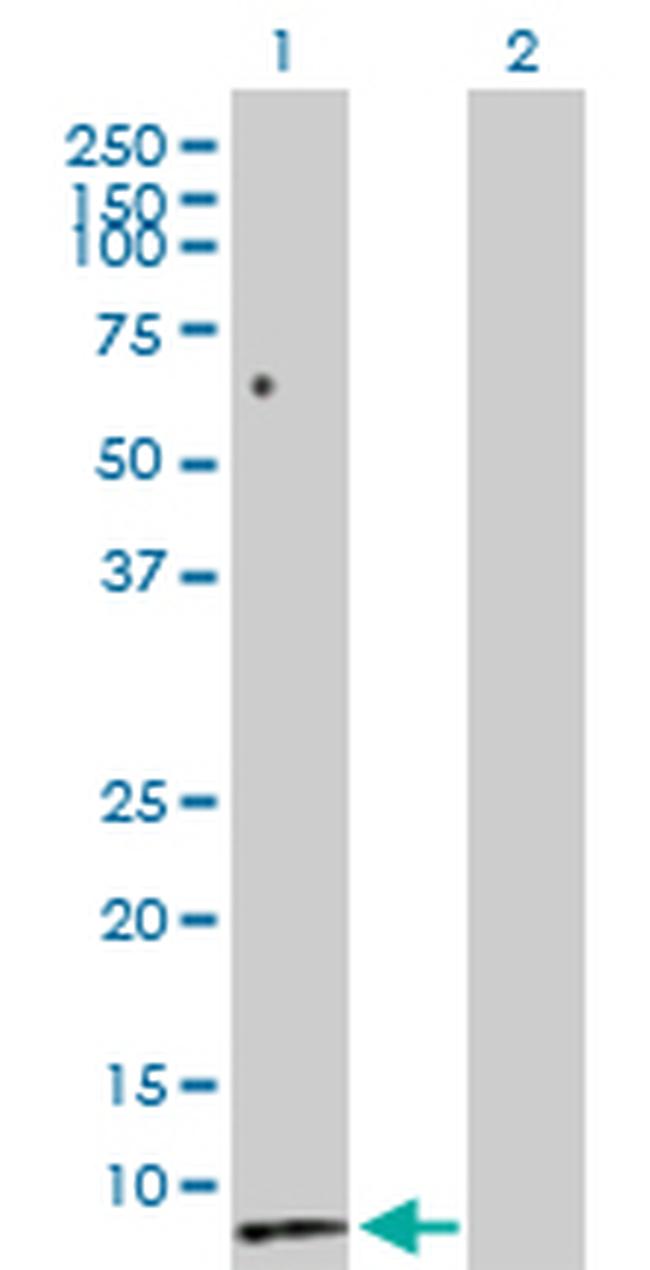 SCT Antibody in Western Blot (WB)