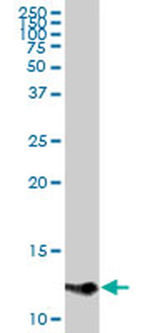 CCL1 Antibody in Western Blot (WB)