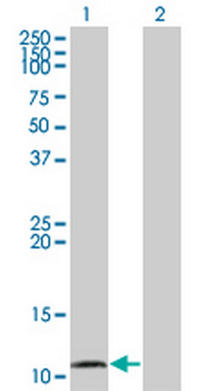 CCL15 Antibody in Western Blot (WB)