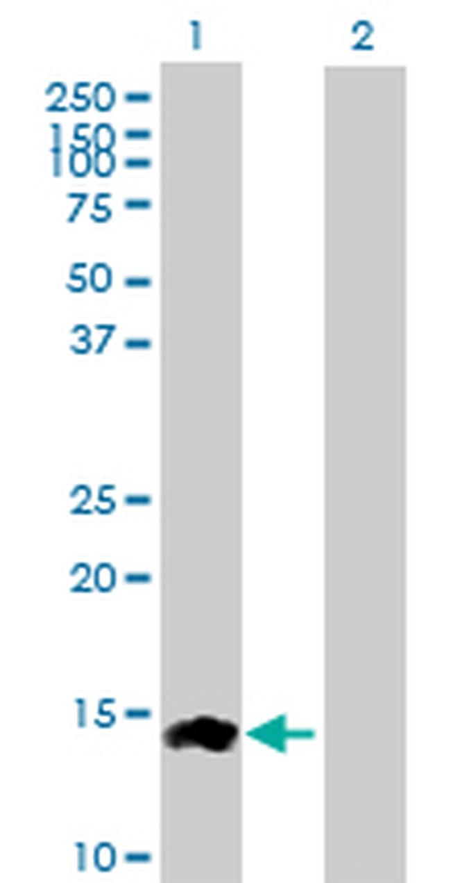 CCL24 Antibody in Western Blot (WB)