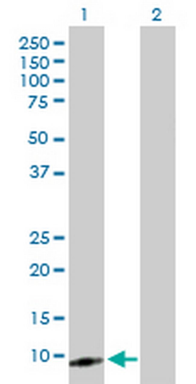 CXCL5 Antibody in Western Blot (WB)