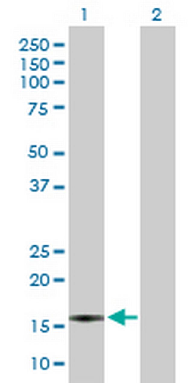 CXCL5 Antibody in Western Blot (WB)