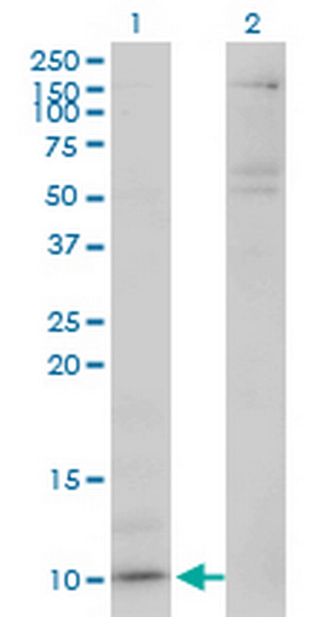 CXCL5 Antibody in Western Blot (WB)