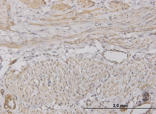 CXCL5 Antibody in Immunohistochemistry (Paraffin) (IHC (P))