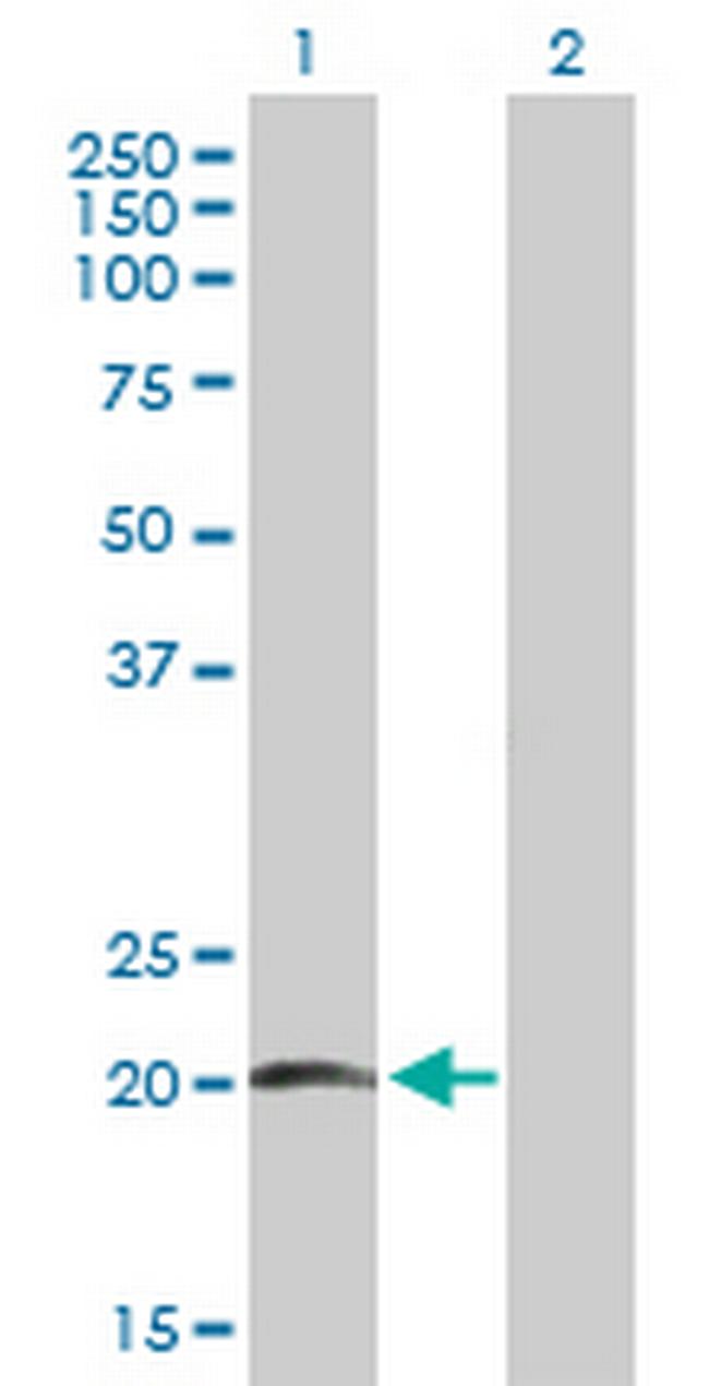 SFTPC Antibody in Western Blot (WB)