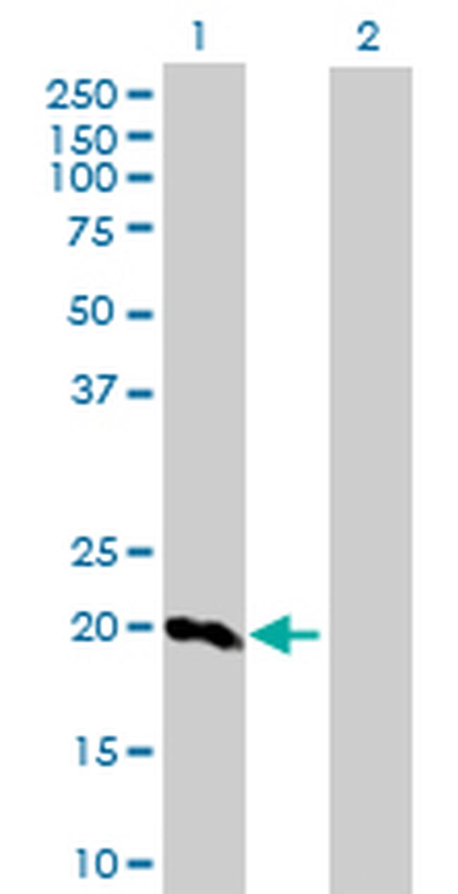 SFTPC Antibody in Western Blot (WB)