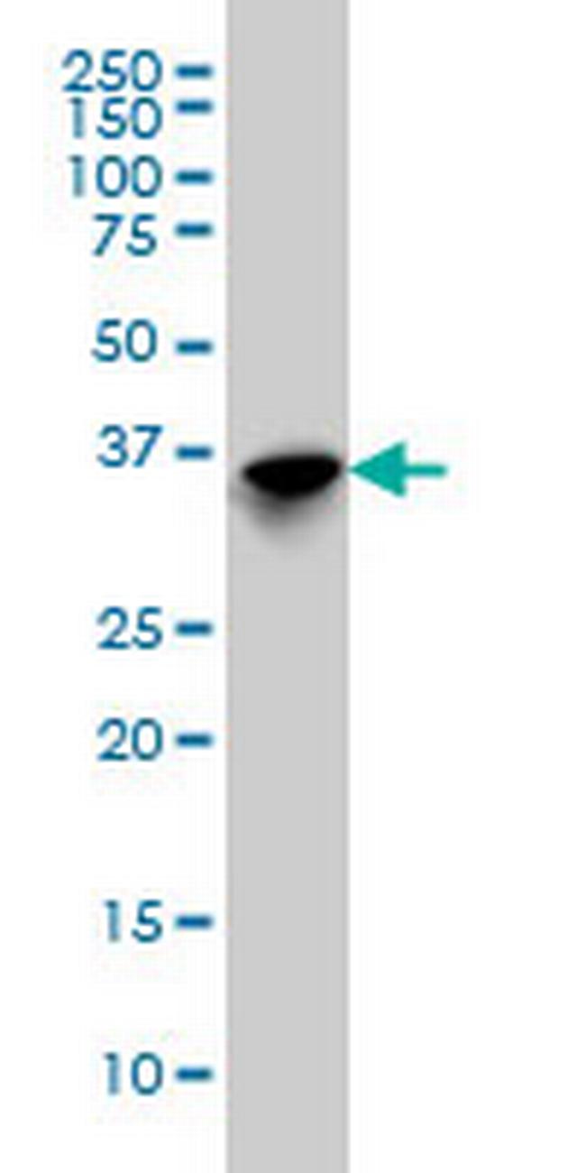 SFTPD Antibody in Western Blot (WB)