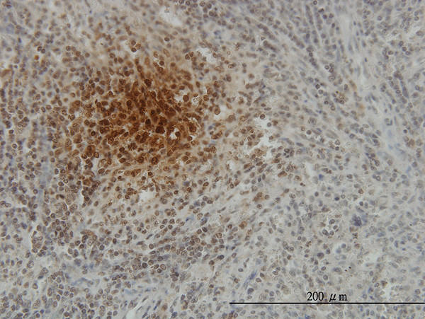 SFTPD Antibody in Immunohistochemistry (Paraffin) (IHC (P))