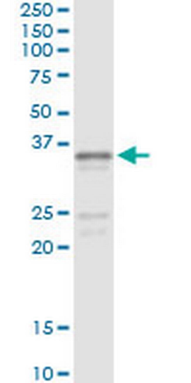 SGCG Antibody in Immunoprecipitation (IP)