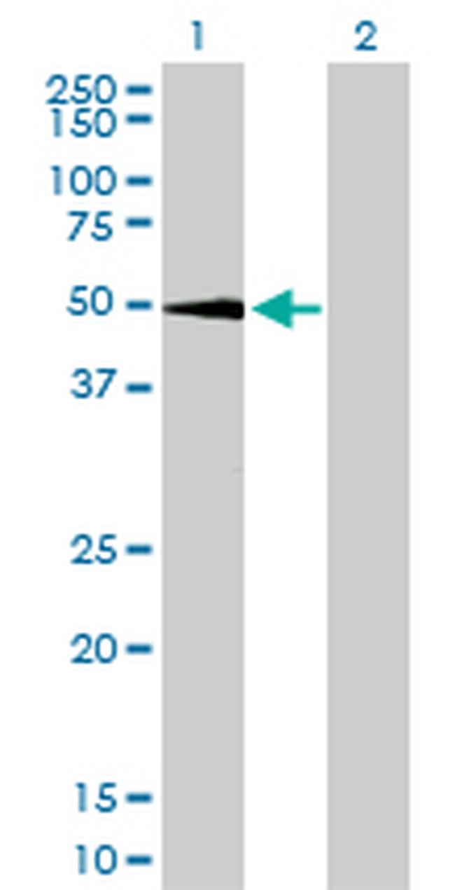 SGK1 Antibody in Western Blot (WB)