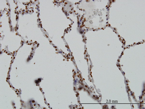 SGK Antibody in Immunohistochemistry (Paraffin) (IHC (P))