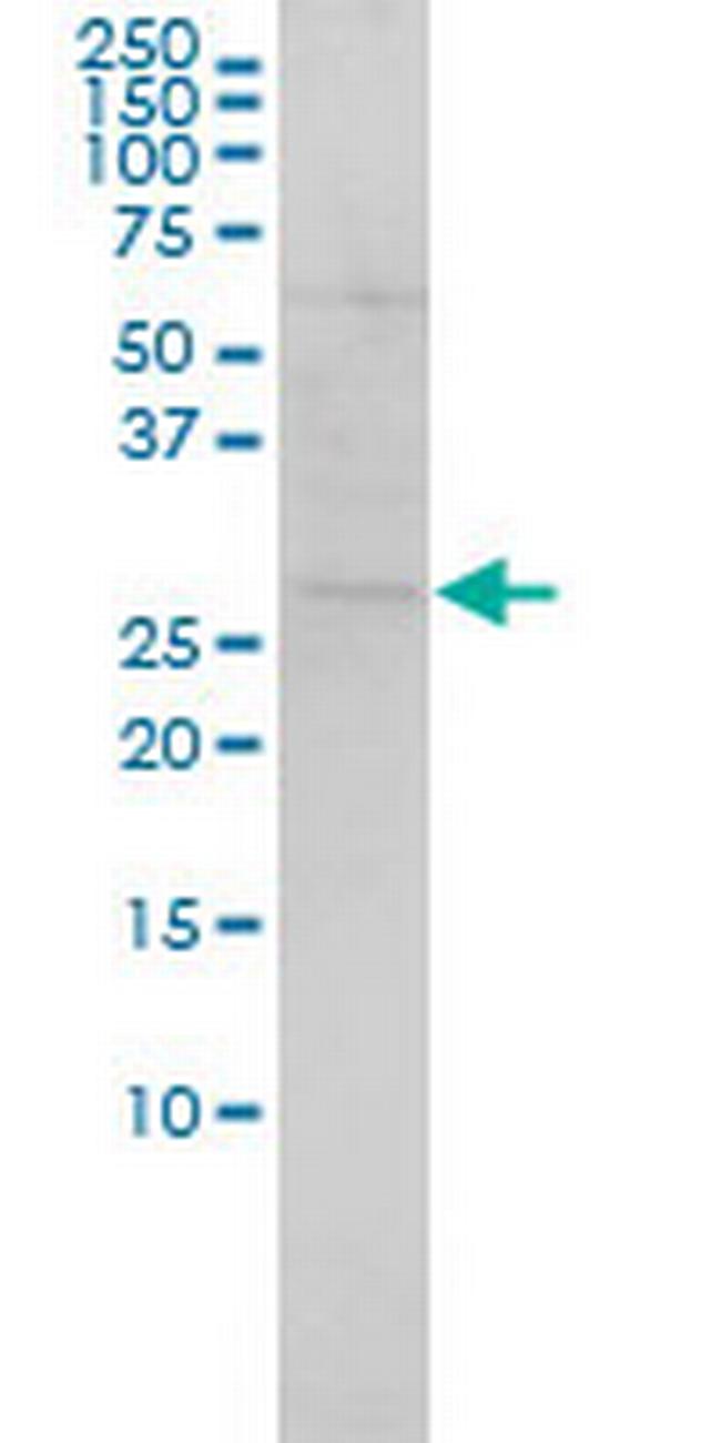 SH3BGR Antibody in Western Blot (WB)