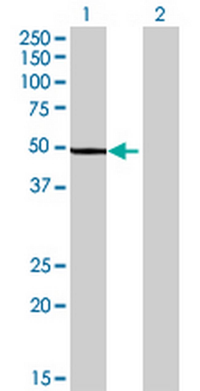 SHMT1 Antibody in Western Blot (WB)