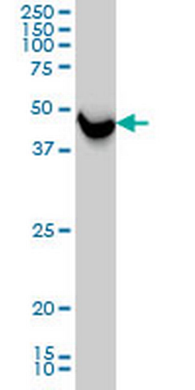 SHMT1 Antibody in Western Blot (WB)