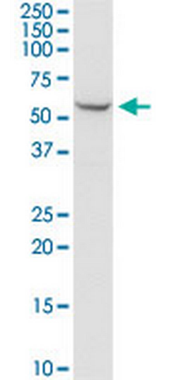 SHMT2 Antibody in Western Blot (WB)