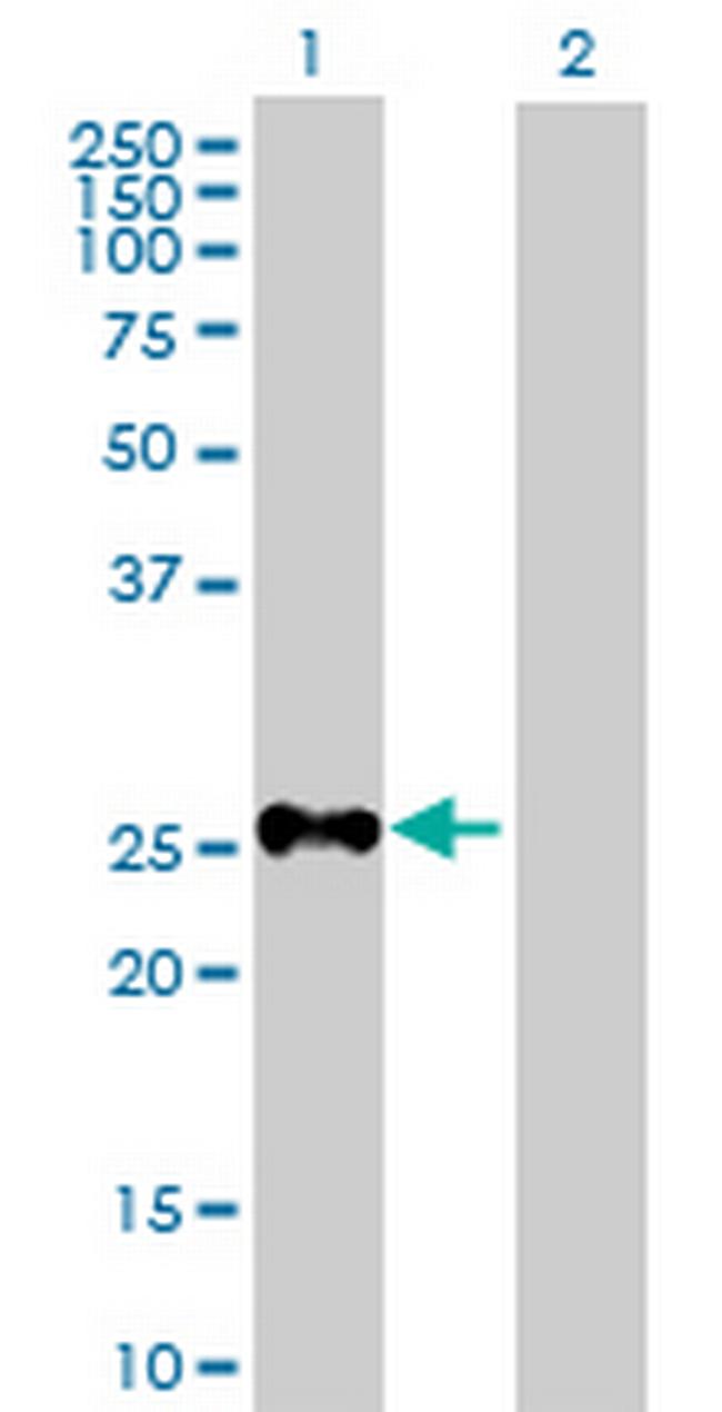 SHOX Antibody in Western Blot (WB)