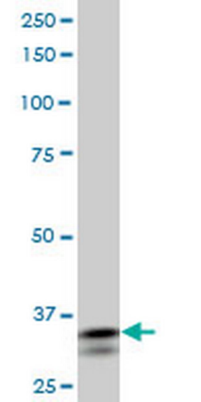 SHOX2 Antibody in Western Blot (WB)