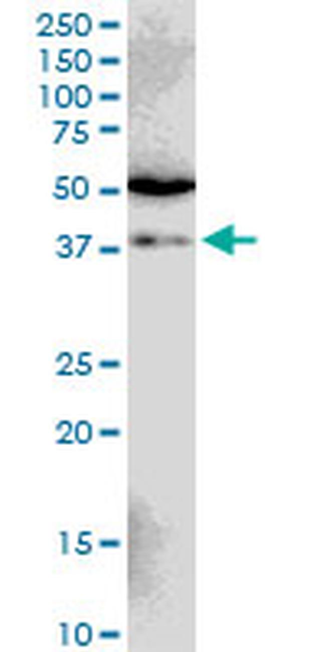 SIAH1 Antibody in Western Blot (WB)