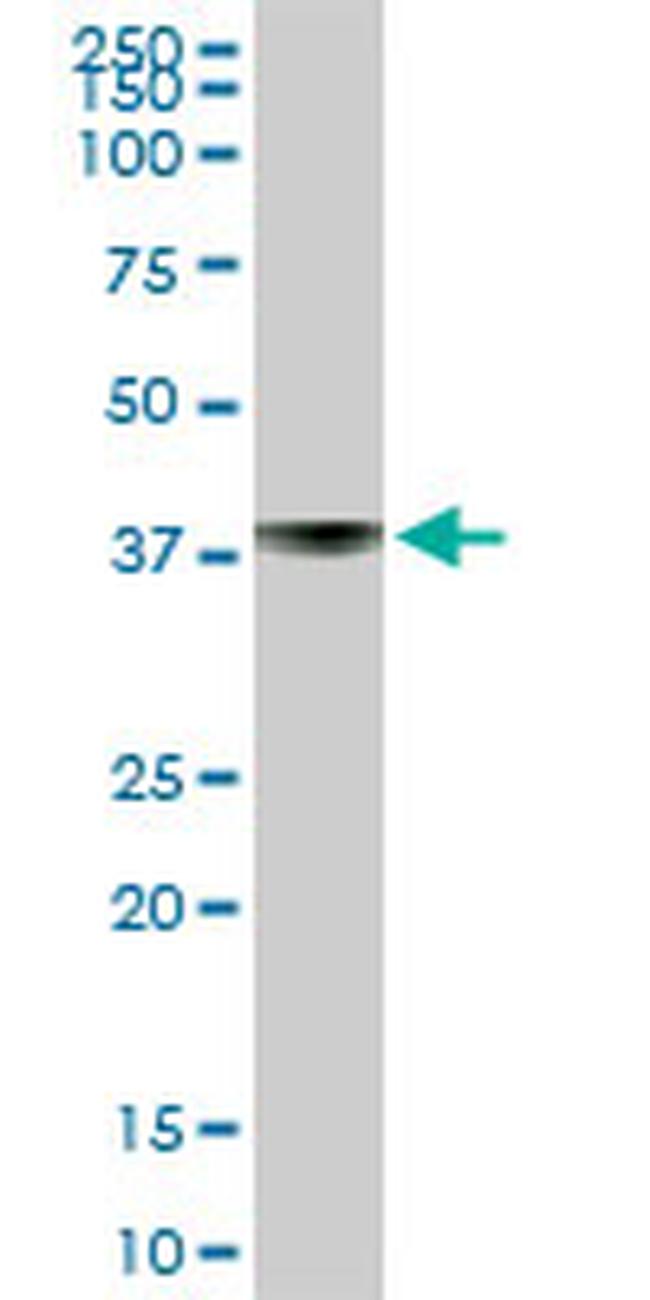 ST6GAL1 Antibody in Western Blot (WB)