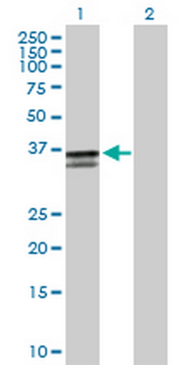 ST3GAL2 Antibody in Western Blot (WB)