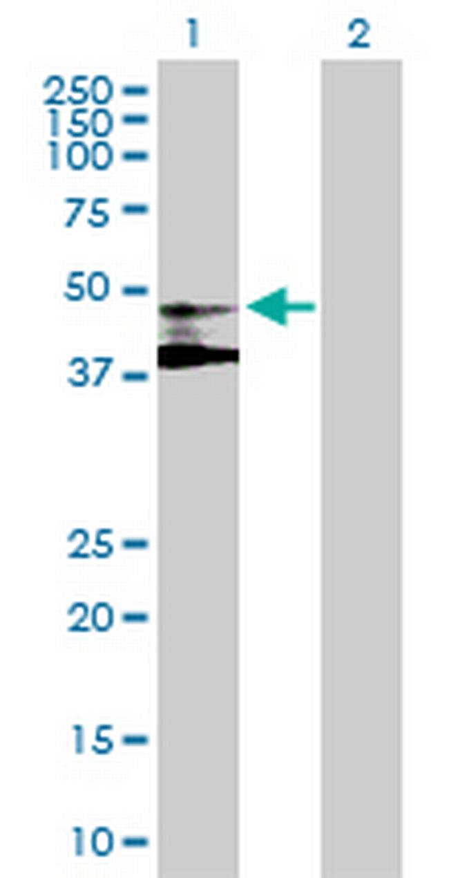 ST3GAL3 Antibody in Western Blot (WB)