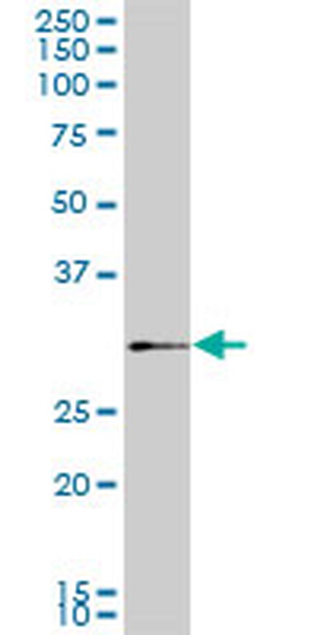 SIX3 Antibody in Western Blot (WB)