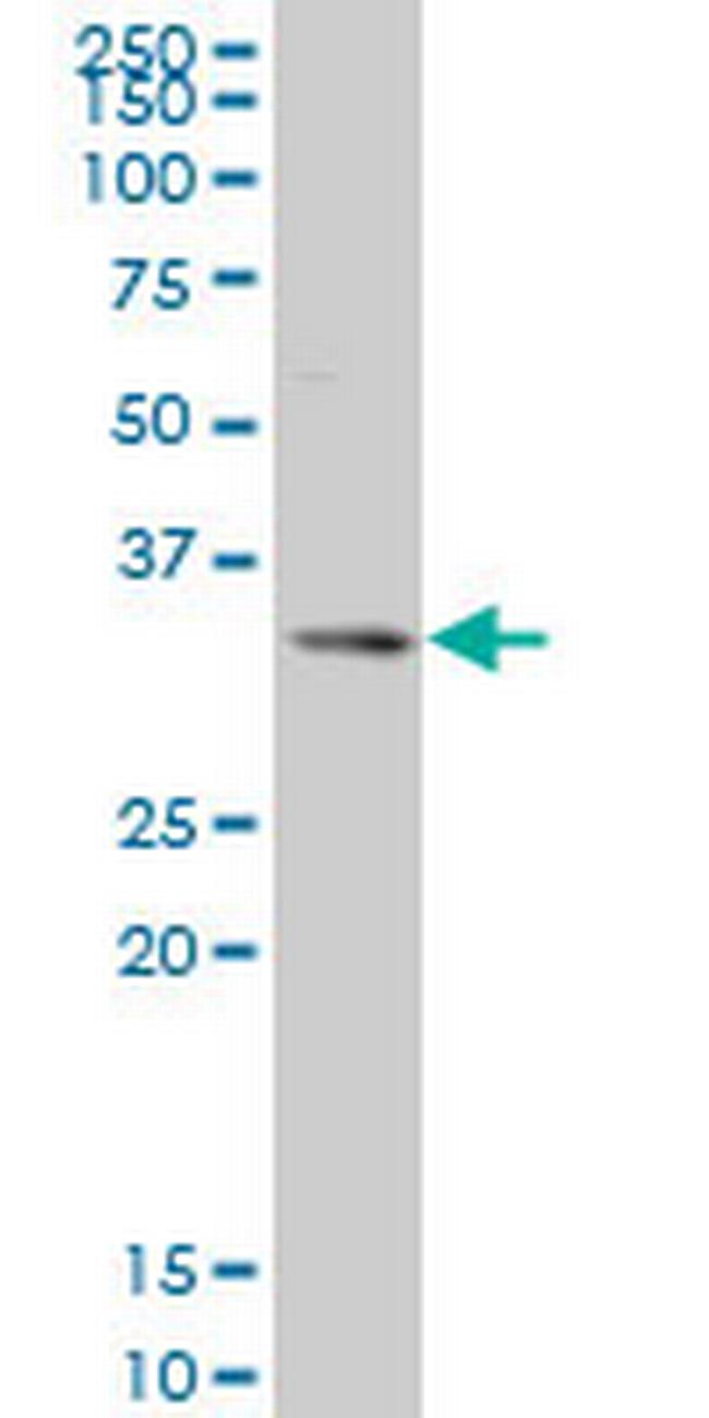 SIX3 Antibody in Western Blot (WB)