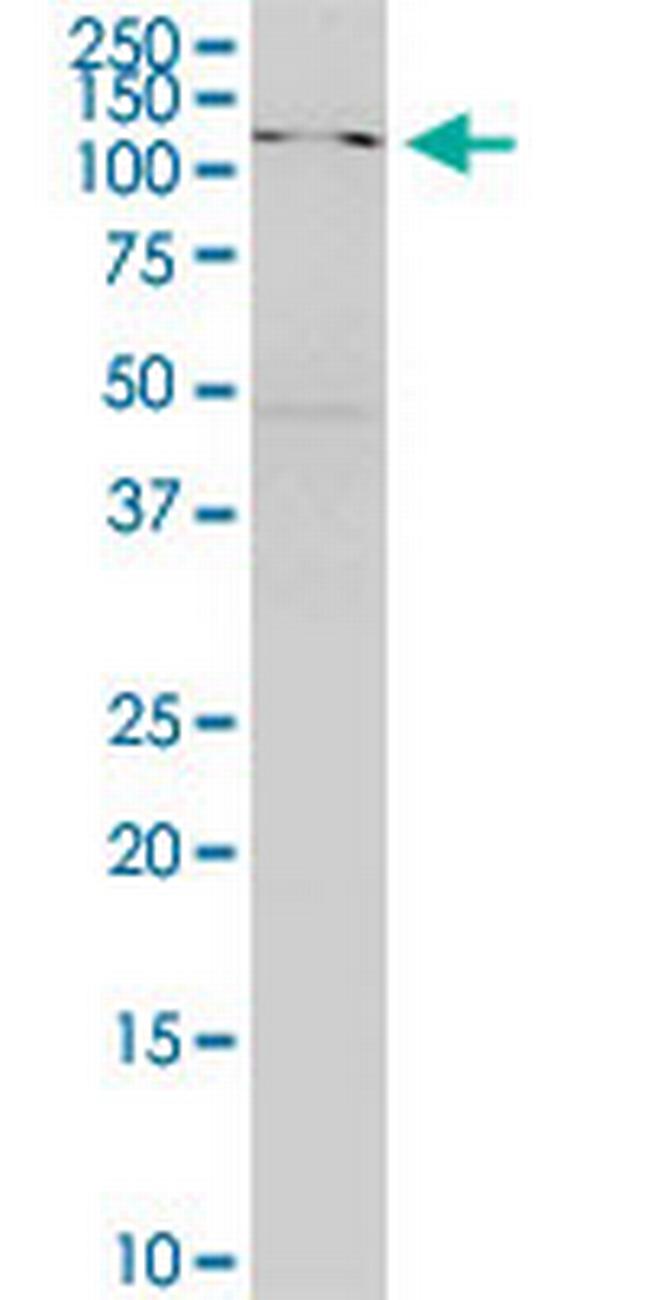 SKIV2L Antibody in Western Blot (WB)