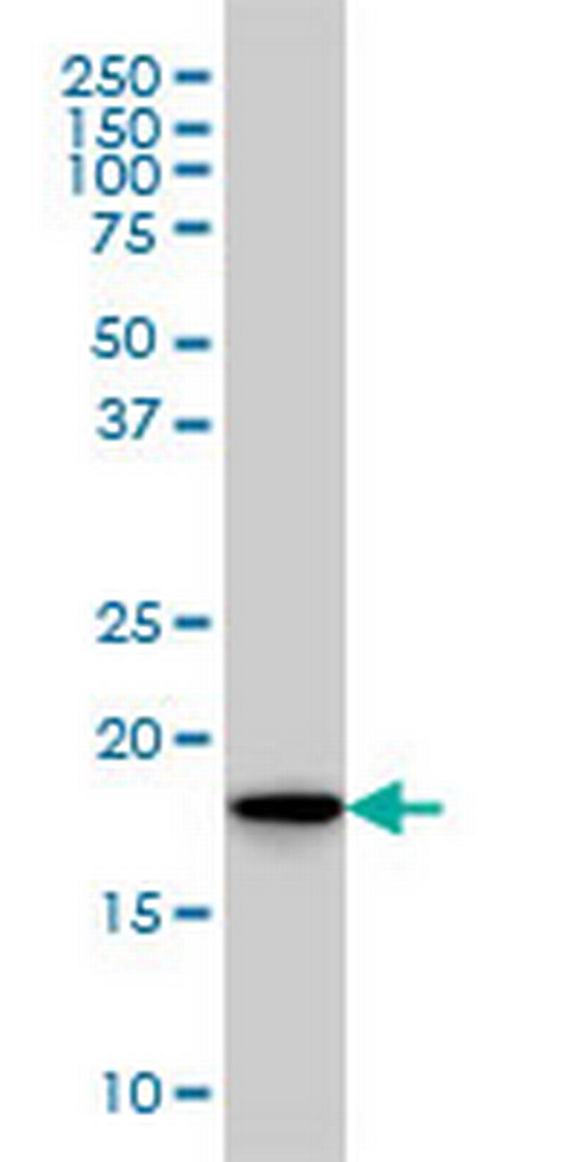 SKP1A Antibody in Western Blot (WB)