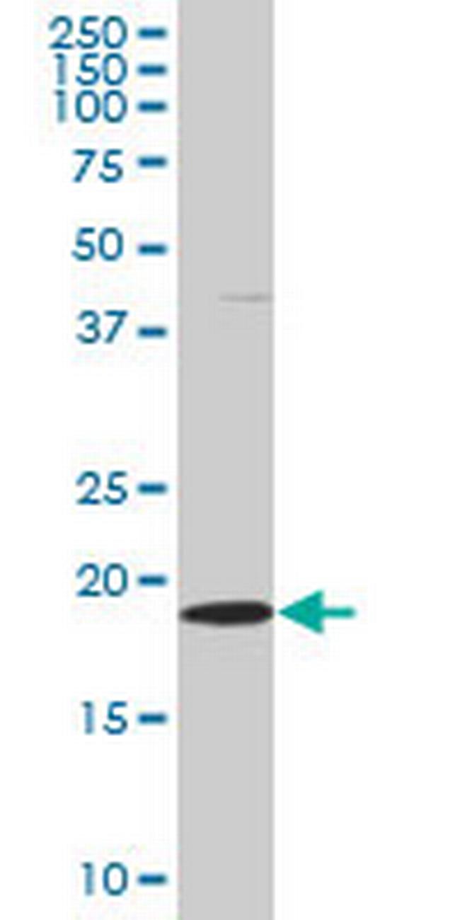 SKP1A Antibody in Western Blot (WB)