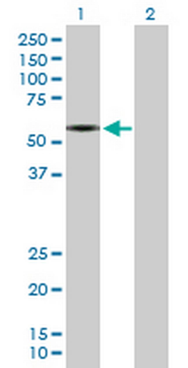 SLC1A2 Antibody in Western Blot (WB)