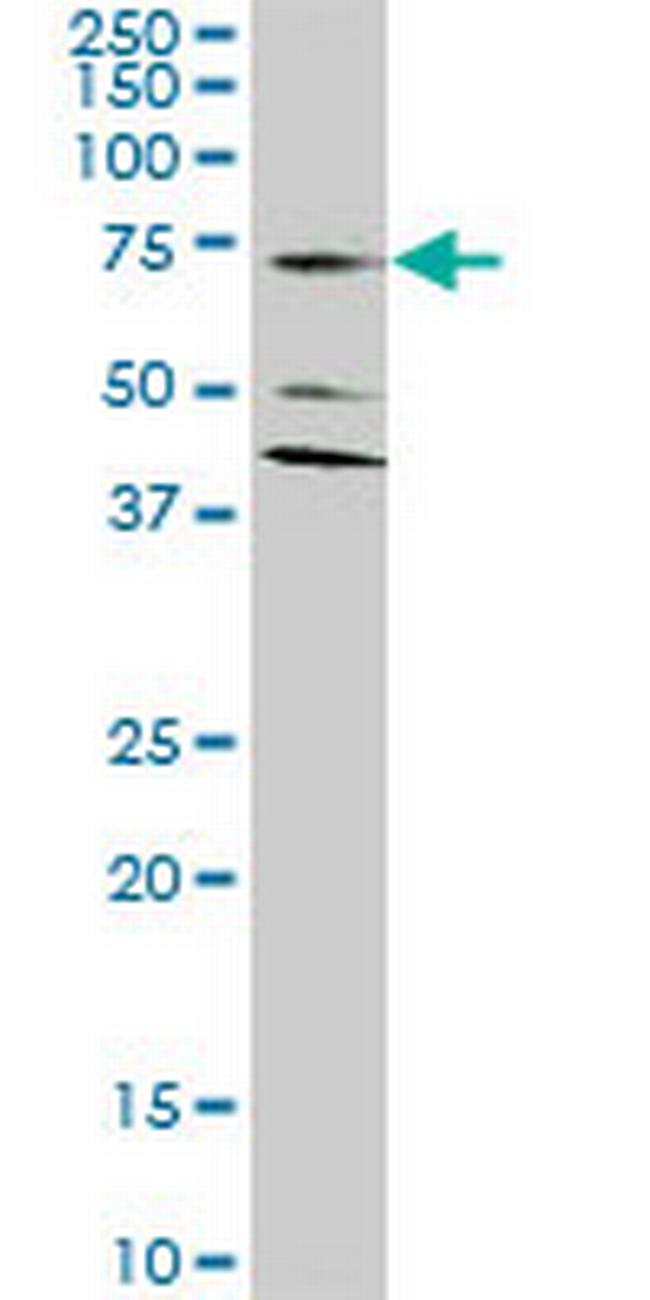 SLC1A2 Antibody in Western Blot (WB)