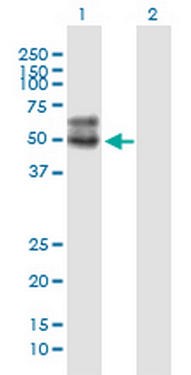 SLC2A4 Antibody in Western Blot (WB)