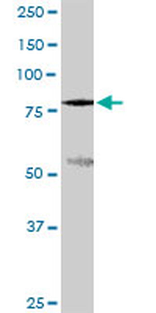 SLC3A1 Antibody in Western Blot (WB)