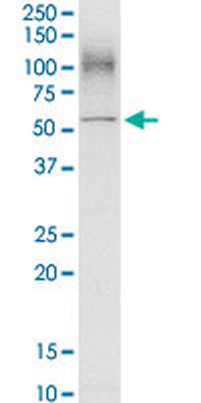 SLC3A2 Antibody in Western Blot (WB)