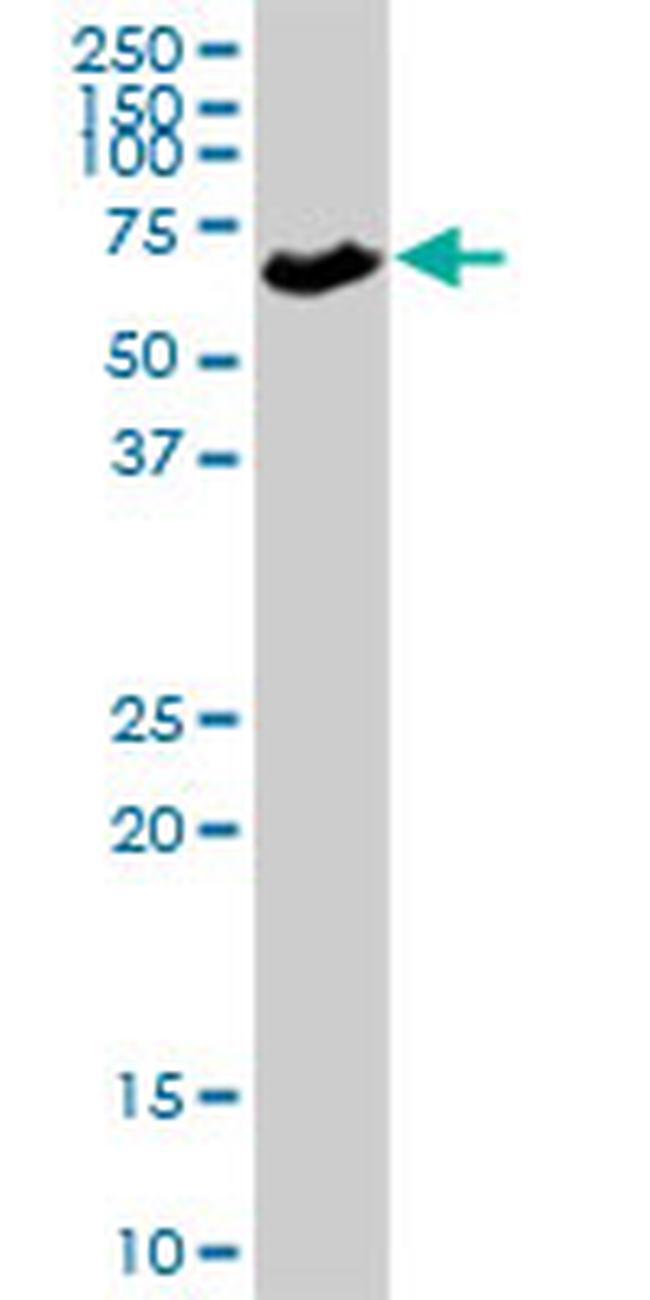 SLC5A1 Antibody in Western Blot (WB)