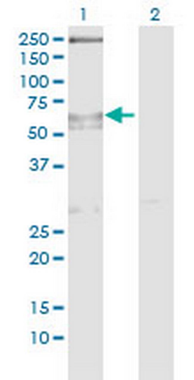 SLC6A1 Antibody in Western Blot (WB)