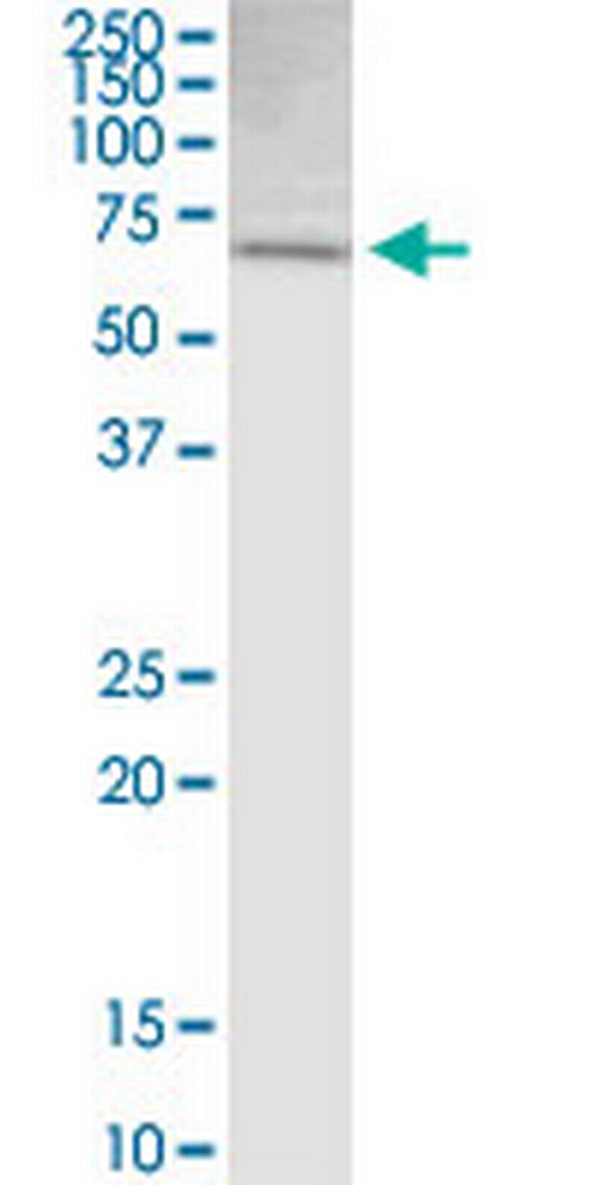 SLC6A3 Antibody in Western Blot (WB)