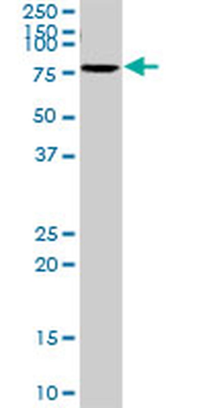 SLC6A4 Antibody in Western Blot (WB)