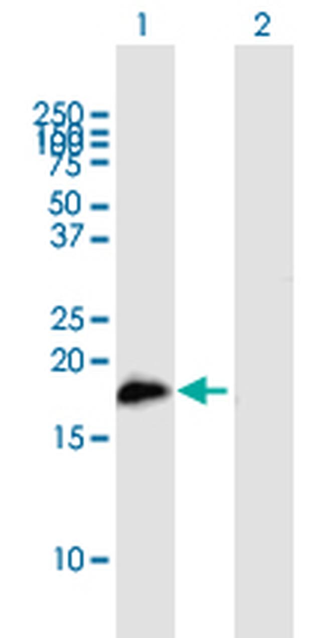 SLC11A1 Antibody in Western Blot (WB)