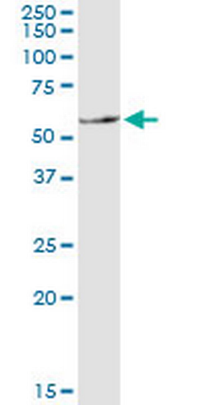 SLC11A1 Antibody in Western Blot (WB)